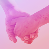 Pediatric Atopic Dermatitis: Role of Advanced Topical Therapies in Optimizing Management