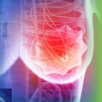 Show Me the Data™: Redefining Treatment Paradigms in Triple-Negative Breast Cancer Across the Disease Continuum