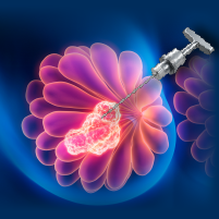 Project ECHO®: Applying PD-L1 Testing in mTNBC: Making Sense of Biomarker-Driven Frontline Care