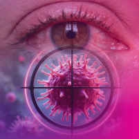 The Optometrist's Role in Recognizing and Managing Ocular Toxicities From Targeted Cancer Therapies