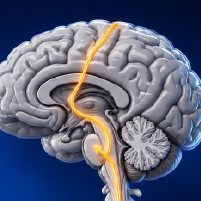 Best Practices in the Diagnosis & Treatment of Amyotrophic Lateral Sclerosis (ALS)