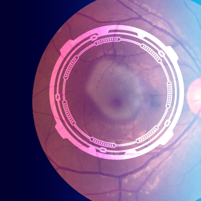 Une Vision d’Espoir: Lighting the Way in GA Management & Treatment