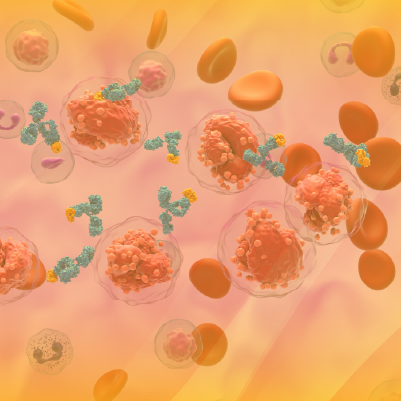 PER® Tumor Board: Charting a New Course in the Treatment of Newly Diagnosed Multiple Myeloma