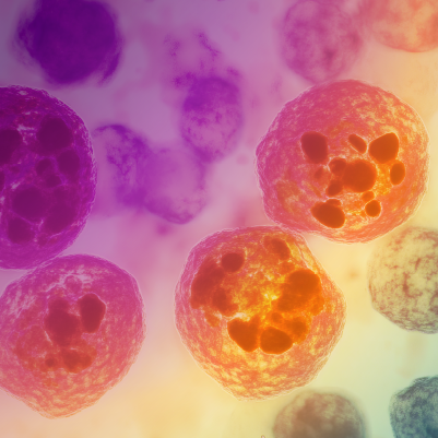 Medical Crossfire®: Strategic Sequencing in ALL — From Asparaginase to Cellular Therapy in an MRD-Driven Era
