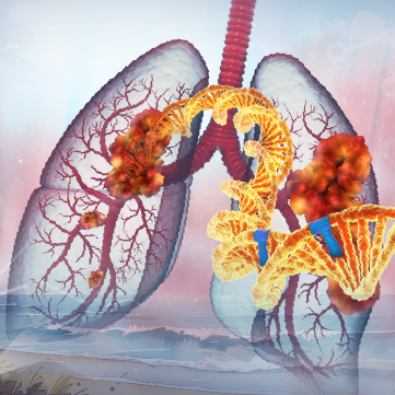 Live Tumor Board: Precision Pathways Transforming Patient Care in Advanced NSCLC