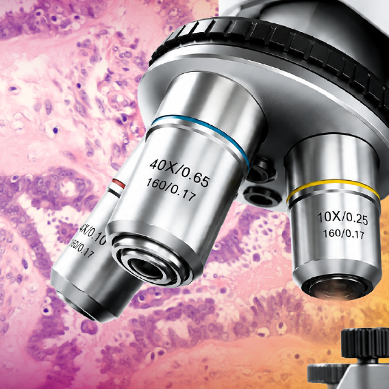 Tumor Board: Enhancing Pathologic Identification and Diagnostic Precision in Low-Grade Serous Ovarian Cancer