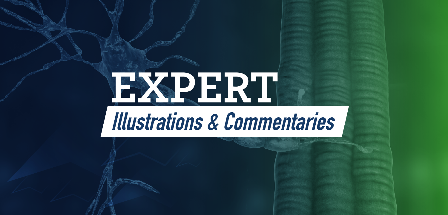 Expert Illustrations & Commentaries™: Visualizing the Role of Dystrophin Dysregulation as a Therapeutic Target in Duchenne Muscular Dystrophy and MD STARnet