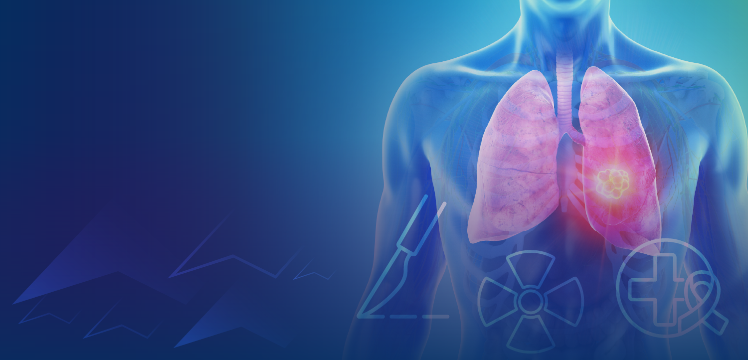 Tumor Board: Evolving Immunotherapy Strategies for Stage I-III NSCLC