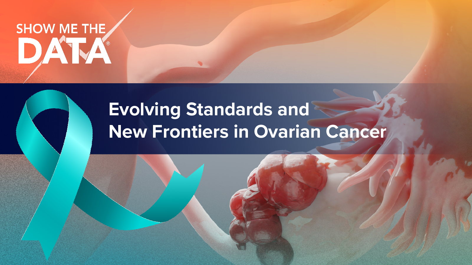 Show Me the Data®: Evolving Standards and New Frontiers in Ovarian Cancer