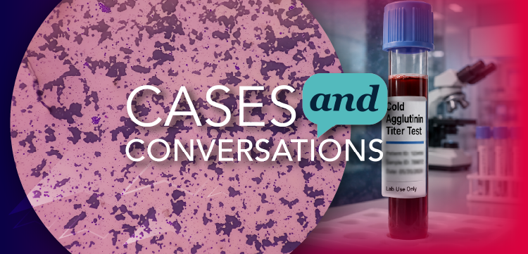 Cases & Conversations: Real-World Insights on the Diagnosis and Management of Cold Agglutinin Disease