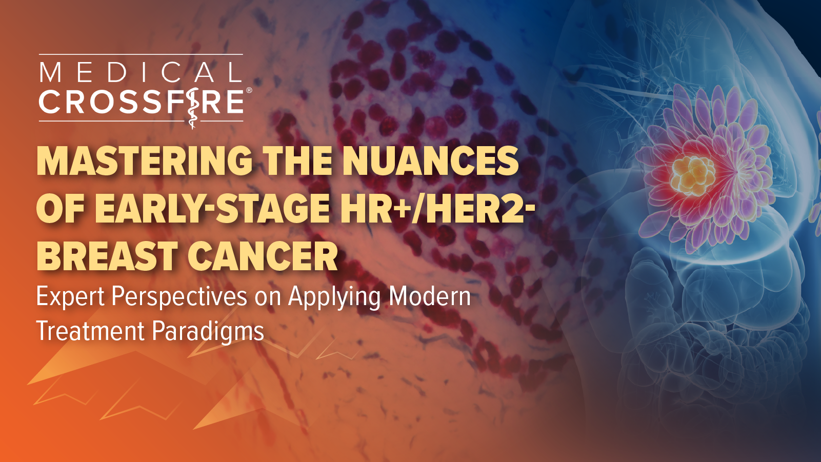 Medical Crossfire®: Mastering the Nuances of Early-Stage HR+/HER2- Breast Cancer—Expert Perspectives on Applying Modern Treatment Paradigms