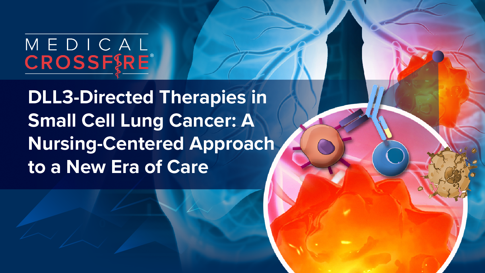 Medical Crossfire®: DLL3-Directed Therapies in Small Cell Lung Cancer—A Nursing-Centered Approach to a New Era of Care