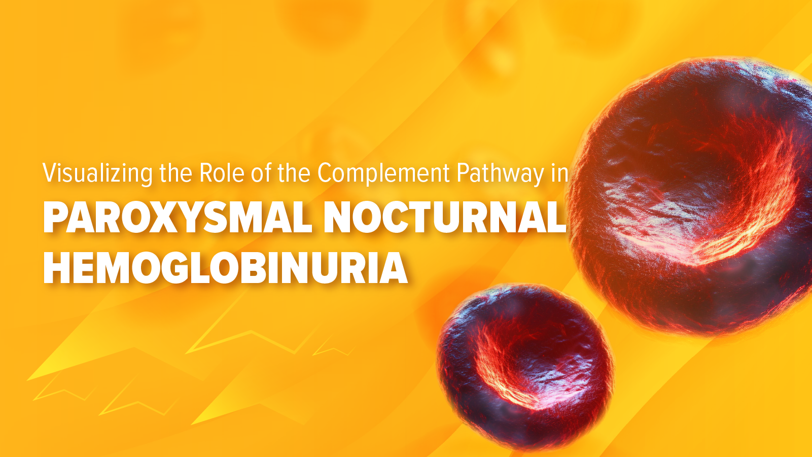 Visualizing the Role of the Complement Pathway in Paroxysmal Nocturnal Hemoglobinuria