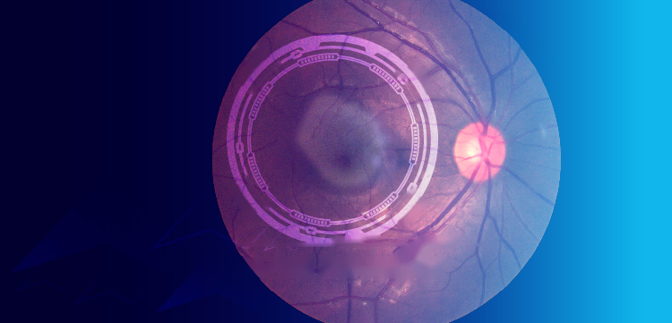 Une Vision d’Espoir: Lighting the Way in GA Management & Treatment