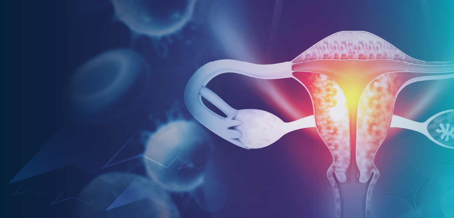 Live Tumor Board: Translating Biomarker Insights and Therapeutic Advances Into Endometrial Cancer Practice
