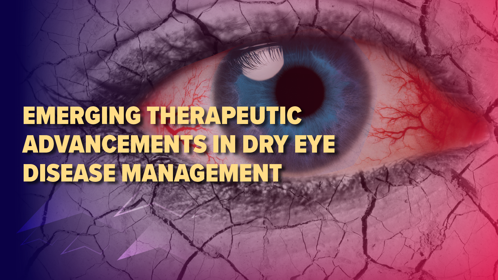 Emerging Therapeutic Advancements in Dry Eye Disease Management