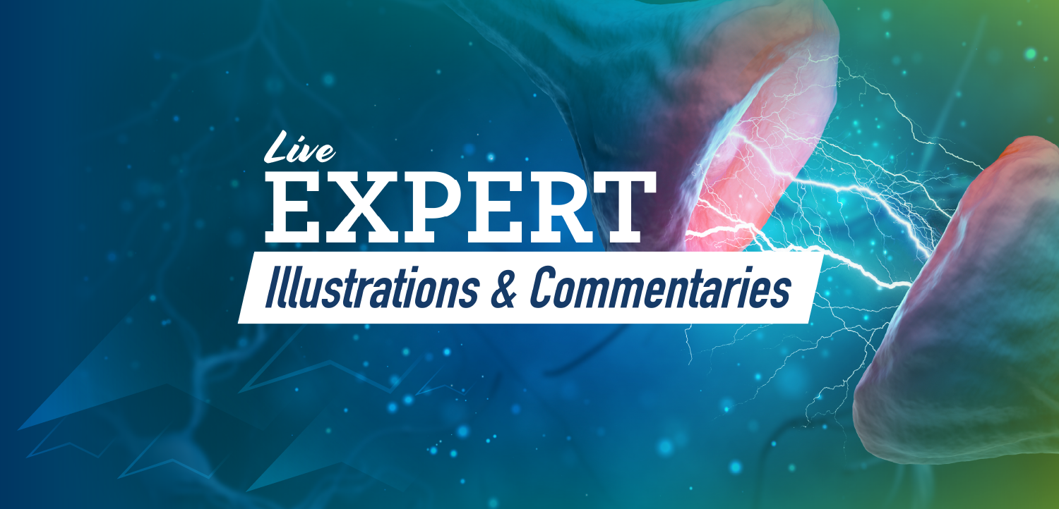 Expert Illustrations & Commentary: Visualizing Novel Therapeutic Targets for Patients with Major Depressive Disorder