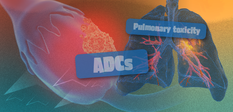 Live Tumor Board: Multidisciplinary Strategies to Prevent and Manage ADC-Associated Pulmonary Toxicities in Ovarian Cancer