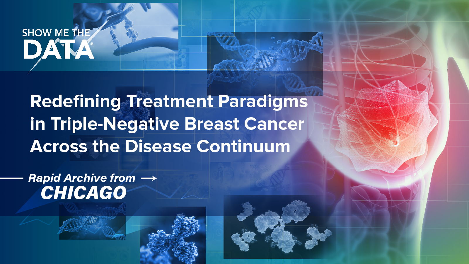 Show Me the Data™: Redefining Treatment Paradigms in Triple-Negative Breast Cancer Across the Disease Continuum