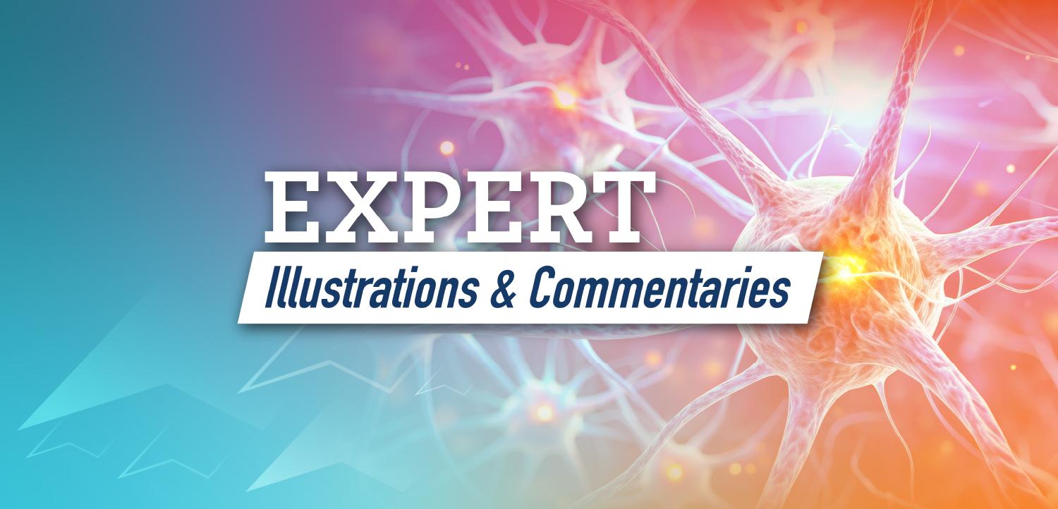 Expert Illustrations & Commentary: Visualizing the Role of Novel Muscarinic Agents in the Management of Schizophrenia