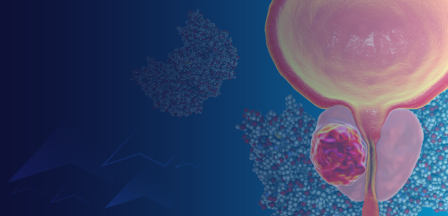 GU Tumor Board: Enhancing Prostate Cancer Outcomes – The Role of PSMA and Targeted Treatment Strategies