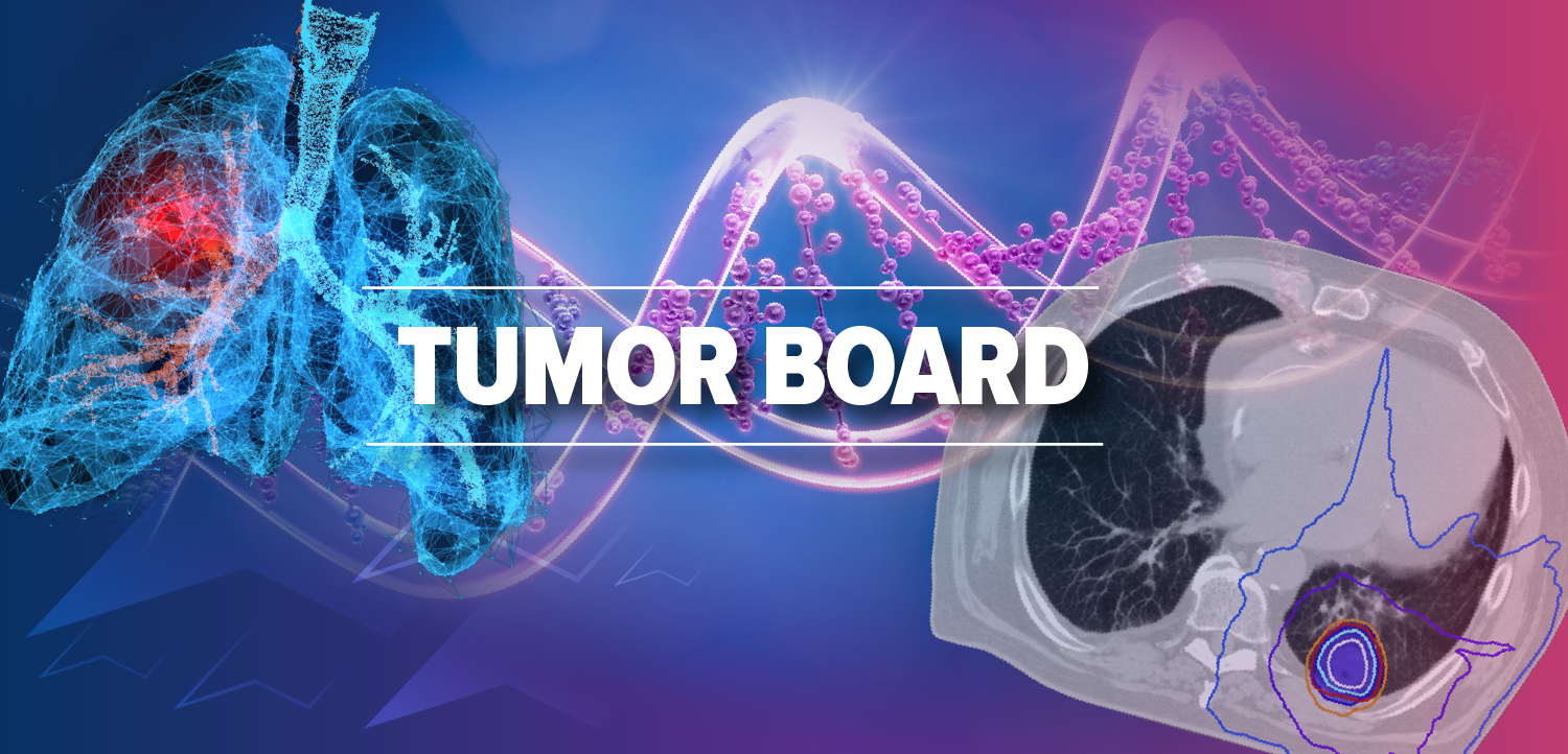 Tumor Board: Integrating Immunotherapy With Definitive and Perioperative Radiation Strategies in Stage I-III NSCLC