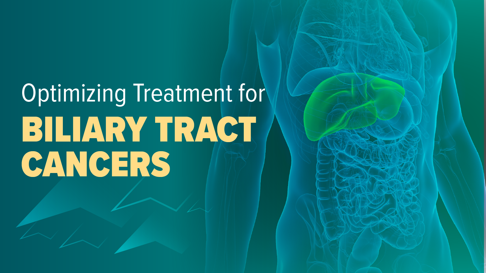 Optimizing Treatment for Biliary Tract Cancers