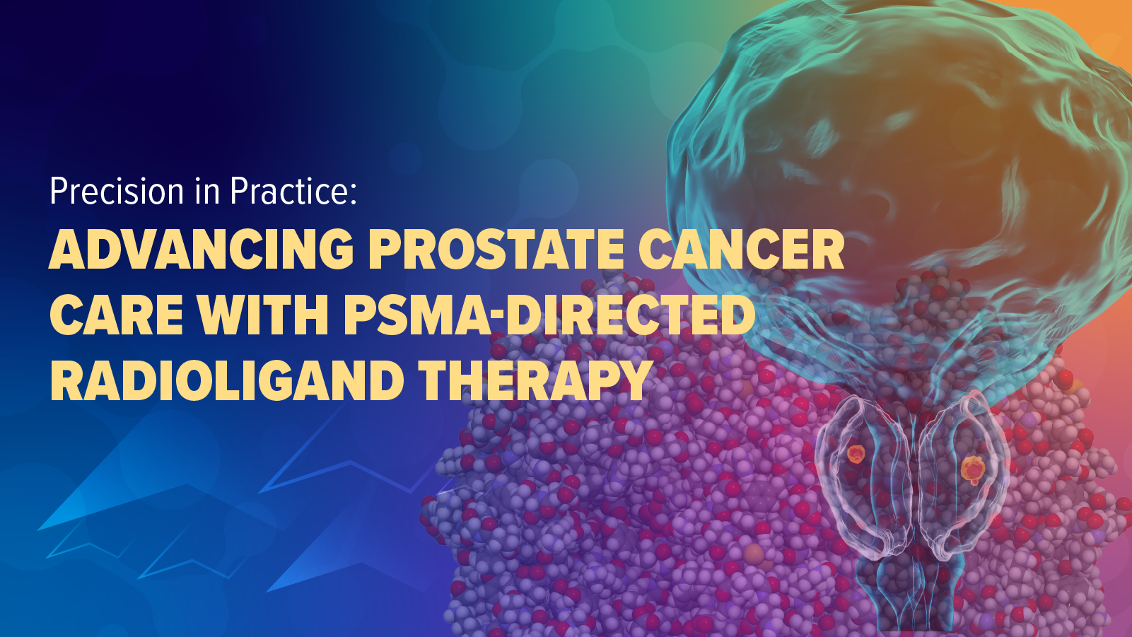 Precision in Practice: Advancing Prostate Cancer Care With PSMA-Directed Radioligand Therapy