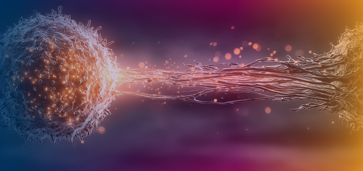 A Community-Based Roadmap to CAR-T Therapy: Optimizing Delivery and Outcomes
