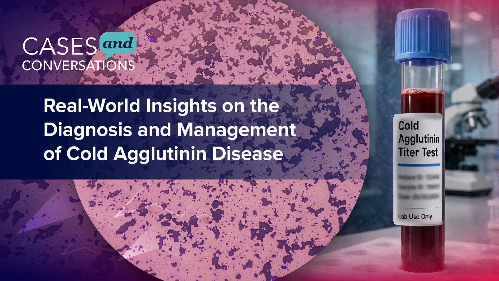 Cases & Conversations: Real-World Insights on the Diagnosis and Management of Cold Agglutinin Disease