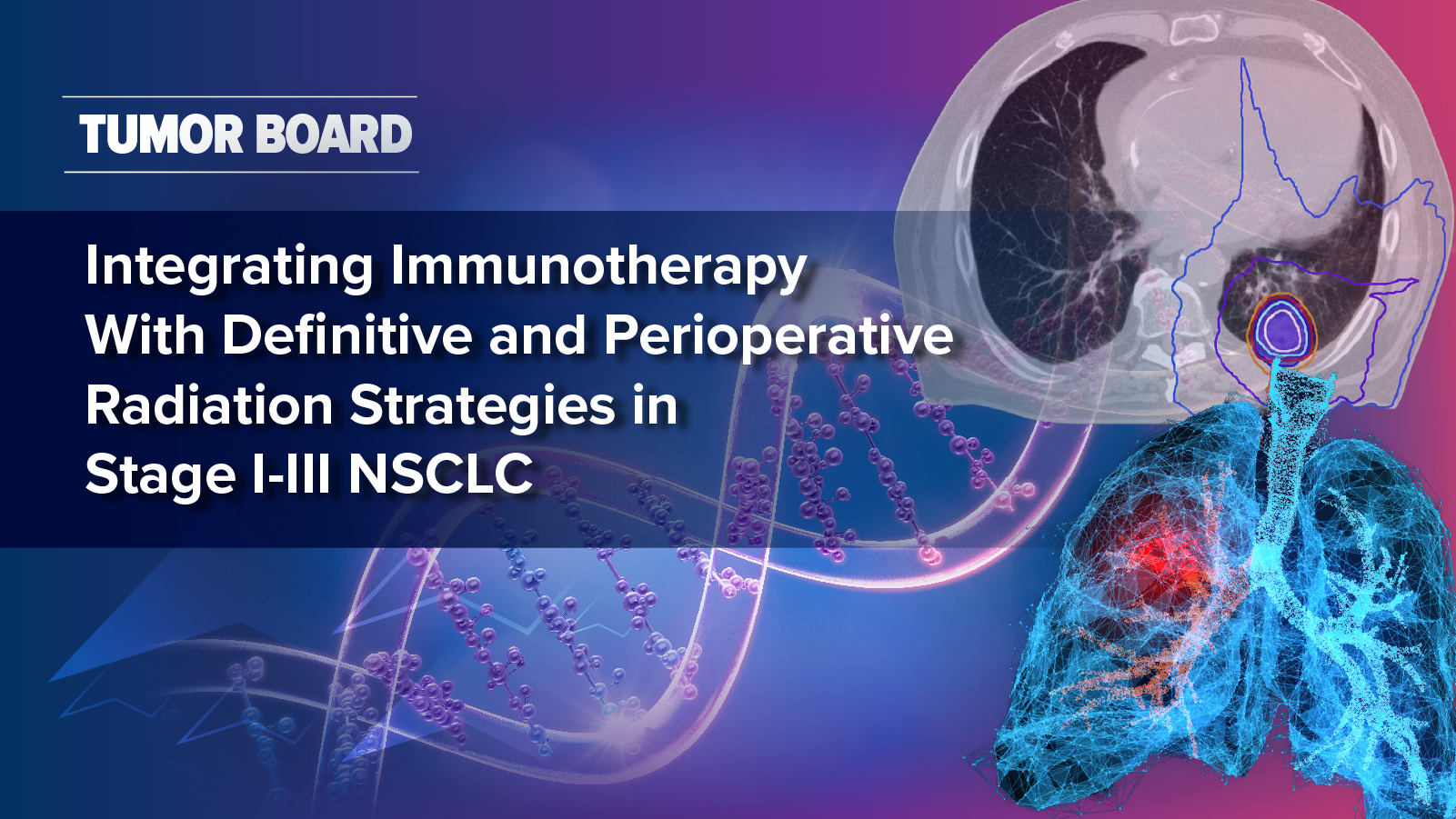 Tumor Board: Integrating Immunotherapy With Definitive and Perioperative Radiation Strategies in Stage I-III NSCLC
