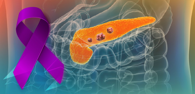 Evolving Treatment Strategies in Pancreatic Cancer: Current Standards, Emerging Targets, and the Role of Molecular Testing