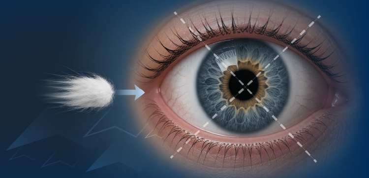 Searching for Silence: Corneal Sensitivity Testing in NK