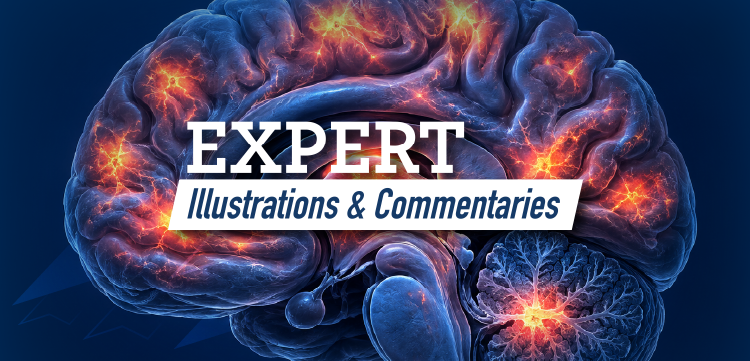 Expert Illustrations & Commentaries™: Outlining the Role of BTK inhibitors in Multiple Sclerosis