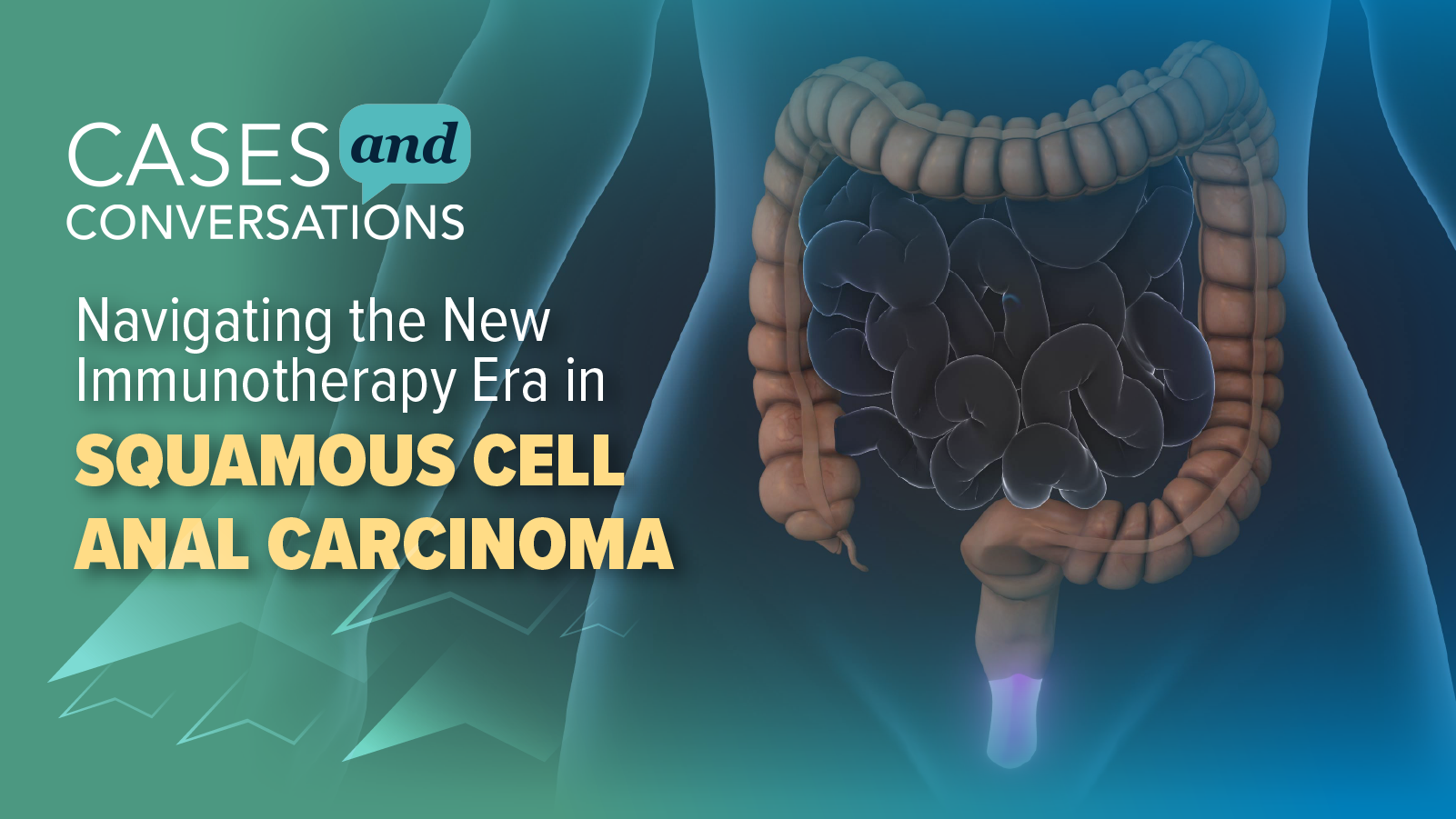 Cases and Conversations: Navigating the New Immunotherapy Era in Squamous Cell Anal Carcinoma
