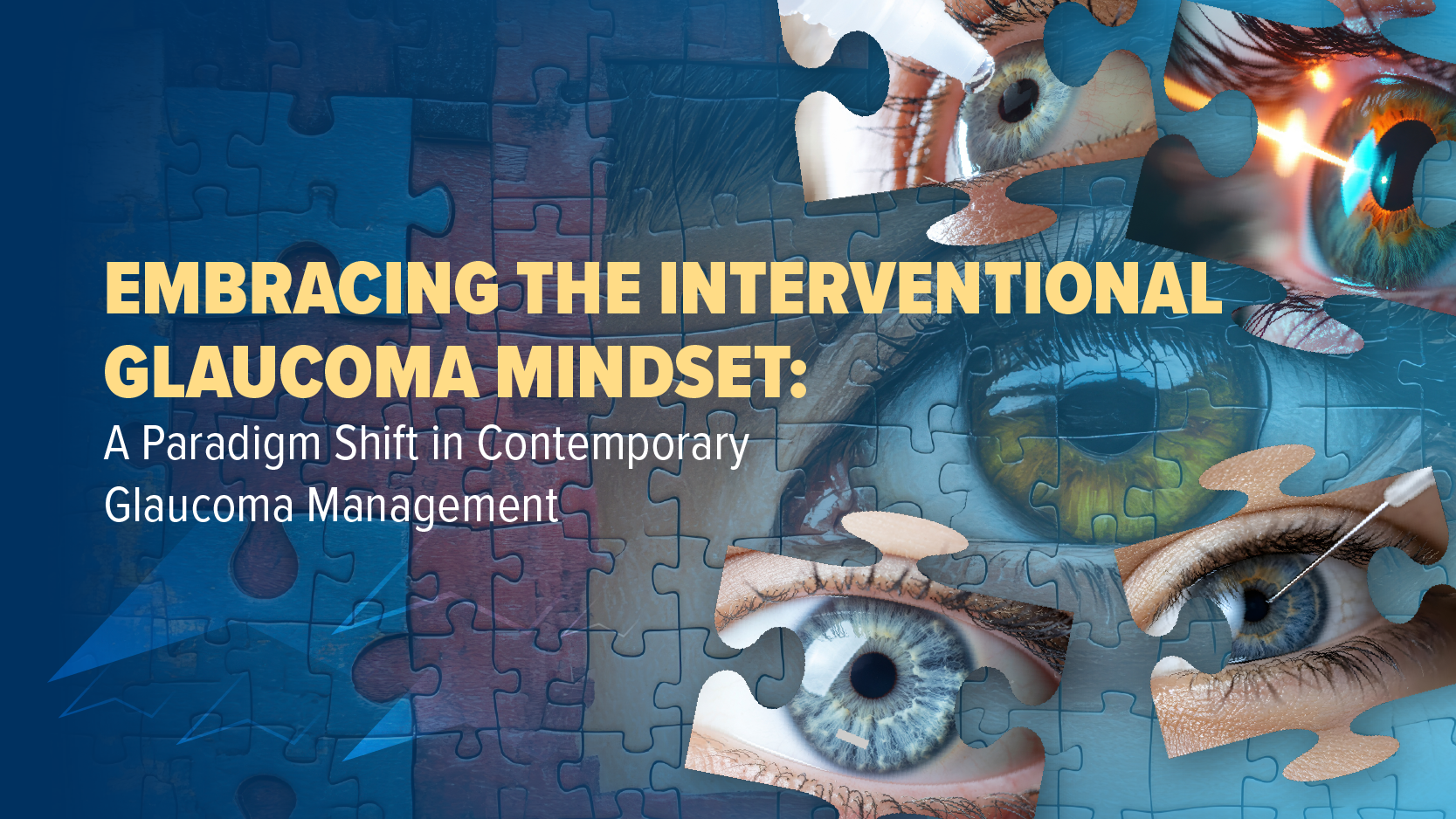 Embracing the Interventional Glaucoma Mindset: A Paradigm Shift in Contemporary Glaucoma Management