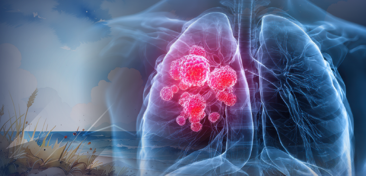 Live Tumor Board: From Trial to Practice–Integrating the Latest Evidence Into the Treatment of EGFR-Mutated NSCLC