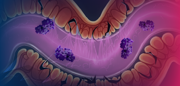 Is TNF-Like Ligand 1A (TL1A) Inhibition the Answer to Improving Disease Remission in Inflammatory Bowel Disease?