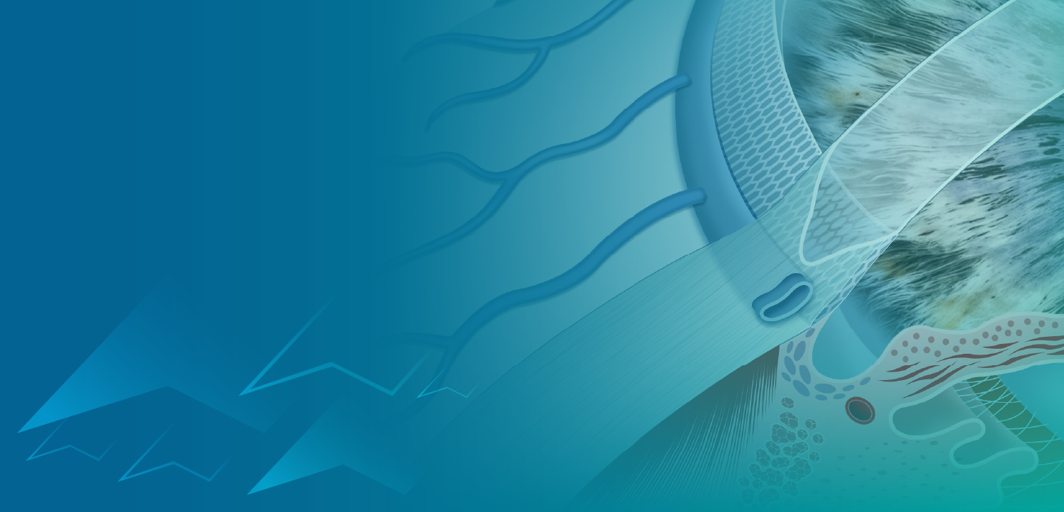 Interventional Glaucoma: The Convergence of Surgical Innovation and Therapeutic Hope