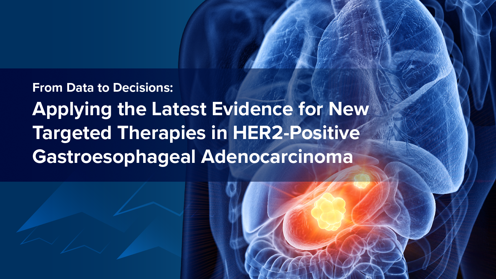 From Data to Decisions: Applying the Latest Evidence for New Targeted Therapies in HER2-Positive Gastroesophageal Adenocarcinoma