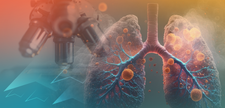PER Tumor Board®: Applying Recent Advances to Transform the Treatment Paradigm in SCLC—Expert Perspectives on New Approvals and Emerging Strategies