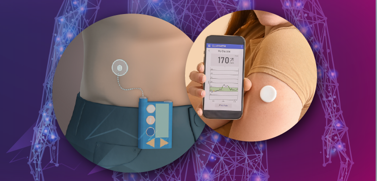 From Numbers to Navigation: Translating CGM Data into Optimized Decision-Making