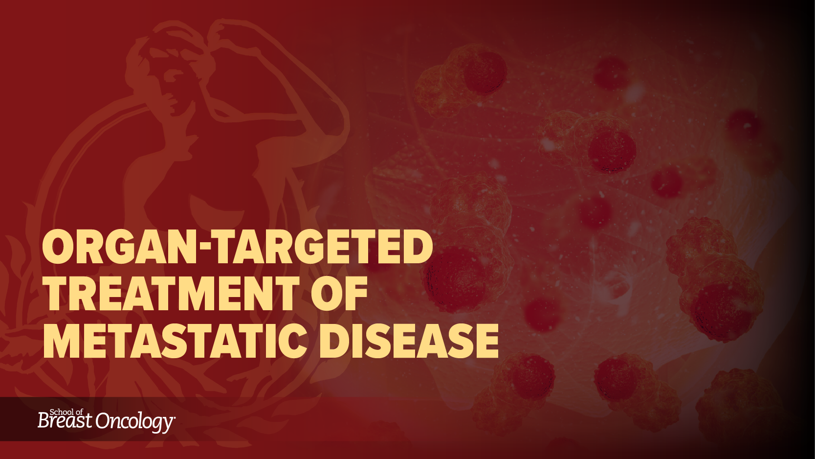 Module 8: Organ-Targeted Treatment of Metastatic Disease (2025)