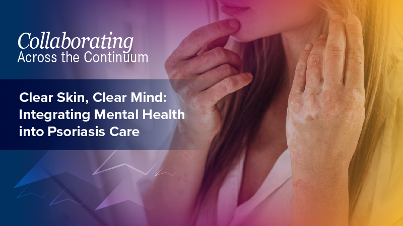 Collaborating Across the Continuum®: Clear Skin, Clear Mind: Integrating Mental Health into Psoriasis Care