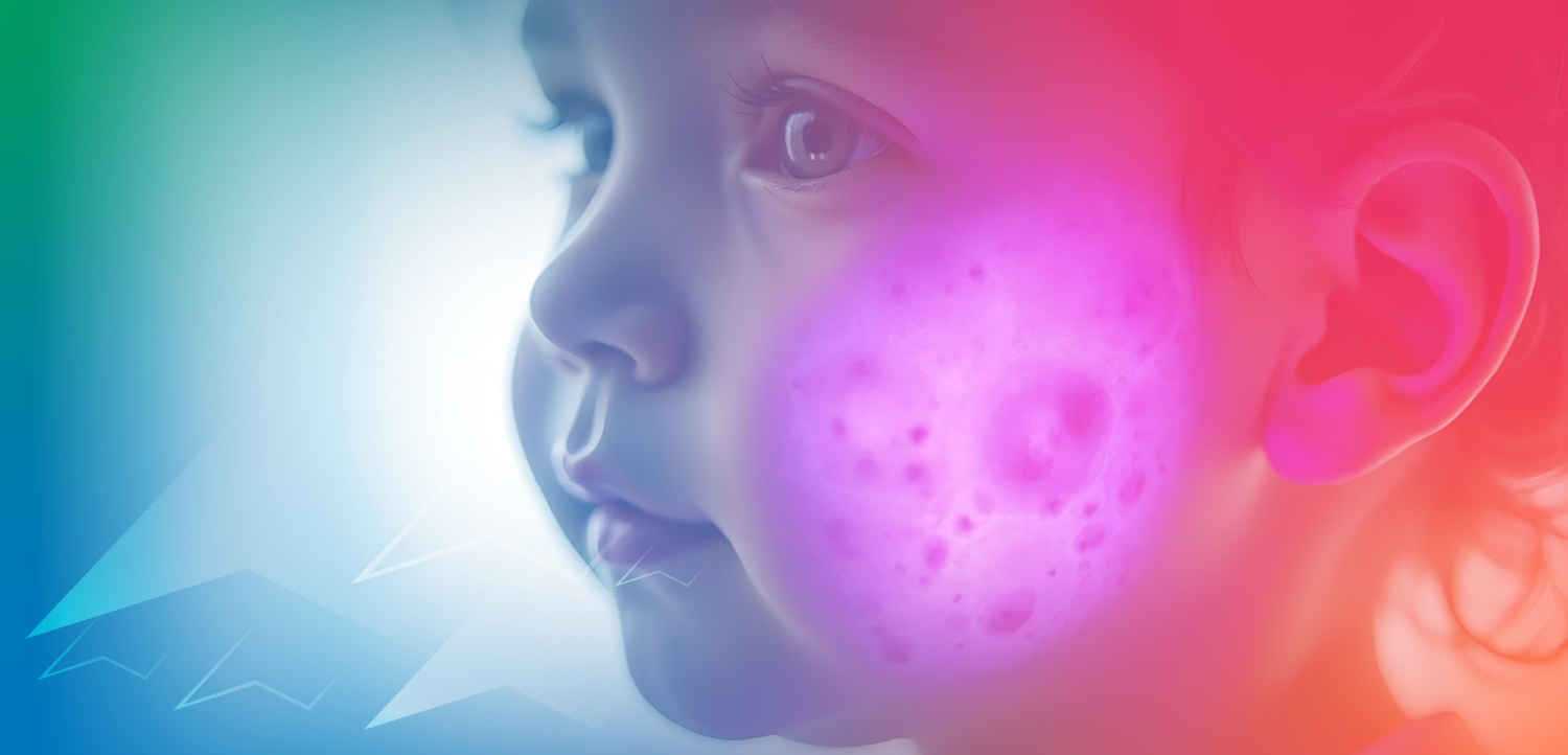 Selecting an Optimal Therapeutic Strategy for the Management of Atopic Dermatitis in Young Children