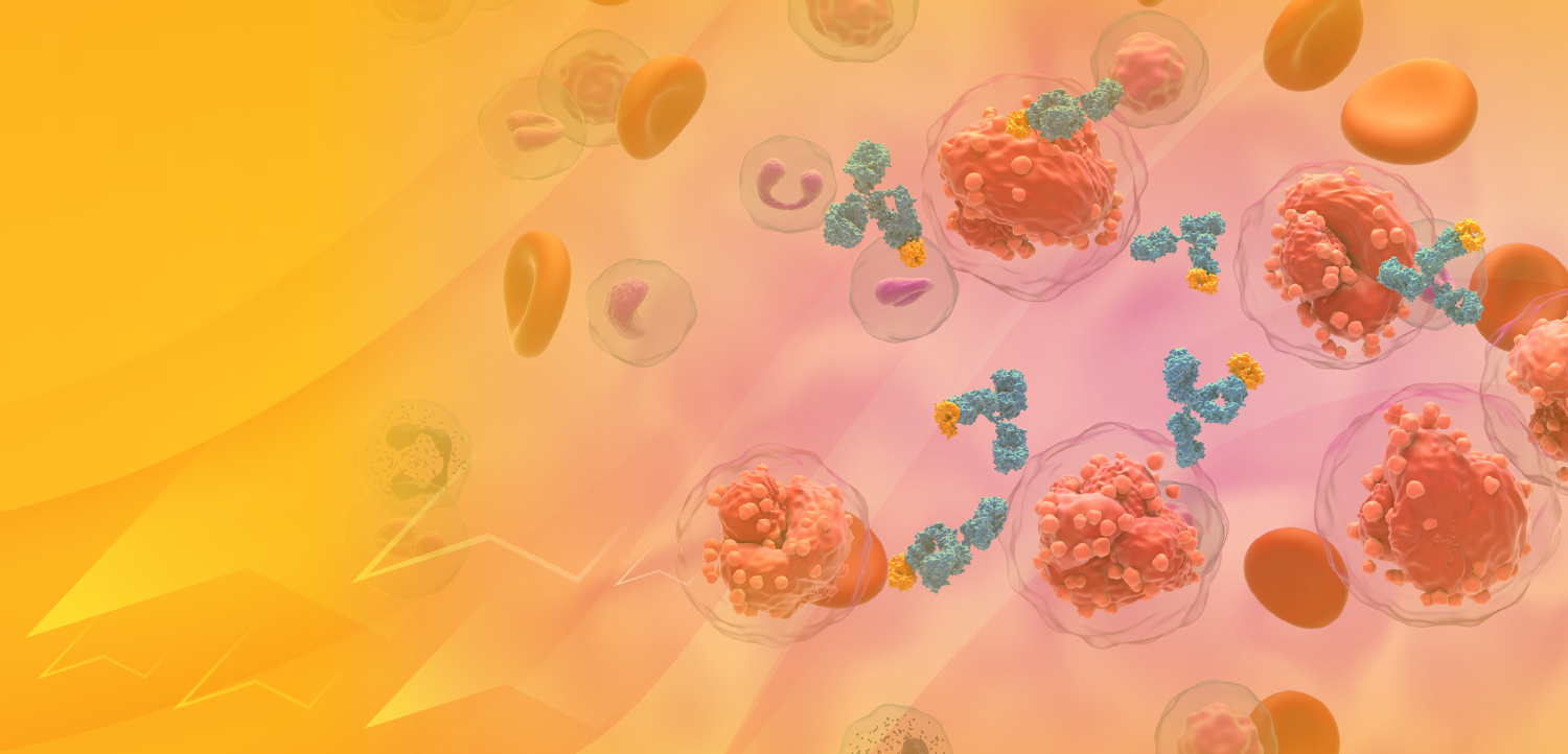 PER® Tumor Board: Charting a New Course in the Treatment of Newly Diagnosed Multiple Myeloma