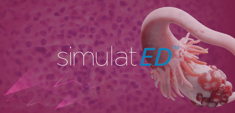 SimulatEd™: A Roadmap to Personalized Care Plans and Shared Decision-Making in Low-Grade Serous Ovarian Cancer