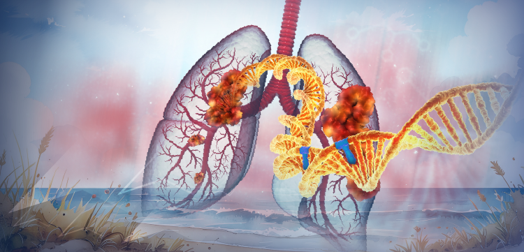 Live Tumor Board: Precision Pathways Transforming Patient Care in Advanced NSCLC