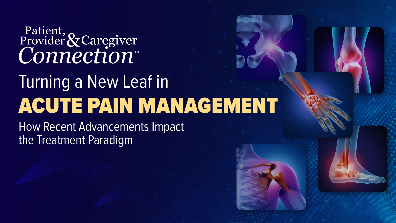 Patient, Provider, and Caregiver Connection: Turning a New Leaf in Acute Pain Management – How Recent Advancements Impact the Treatment Paradigm