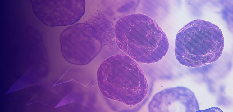 Navigating the Evolving Landscape of Acute Lymphoblastic Leukemia